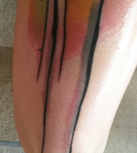 Poppy124: nach 4/5 Wochen: seltsame "Rötung" ?!?